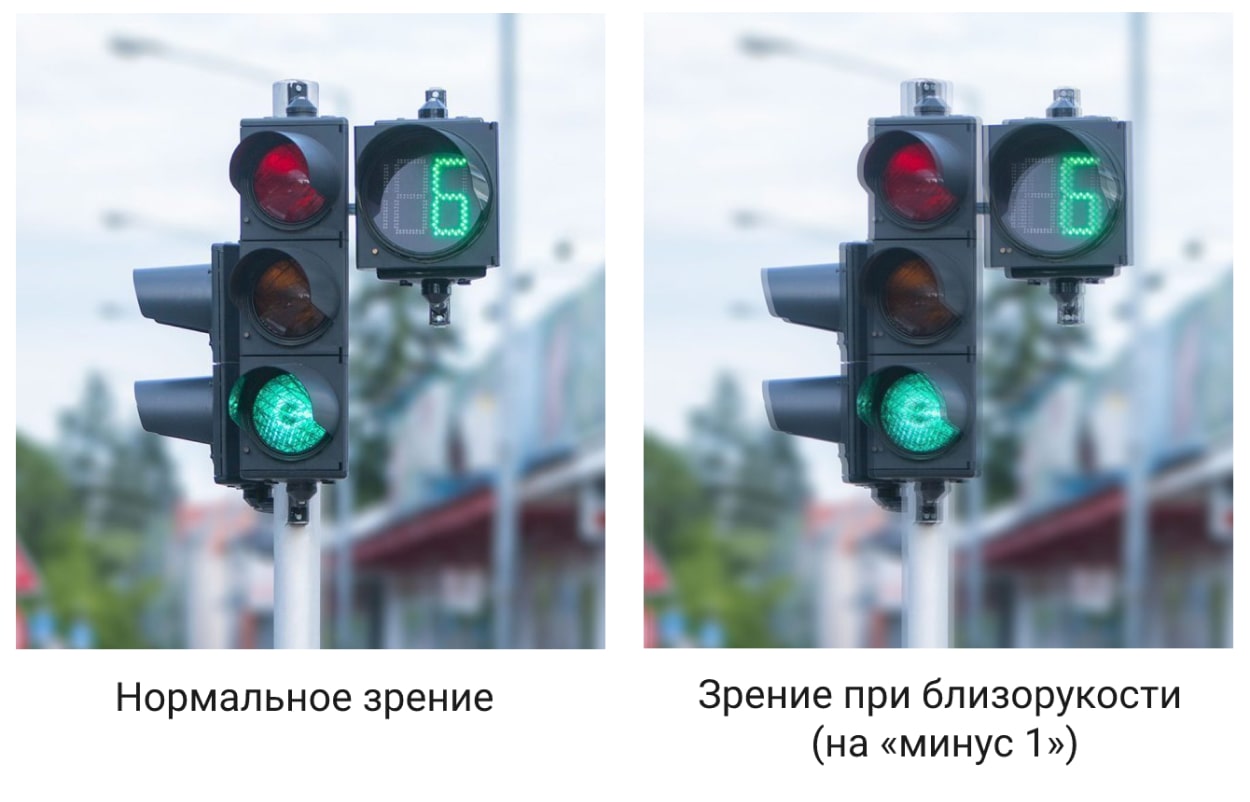 Зрение на «минус 1»