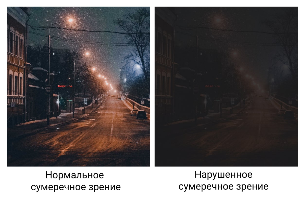 Гемералопия — куриная слепота