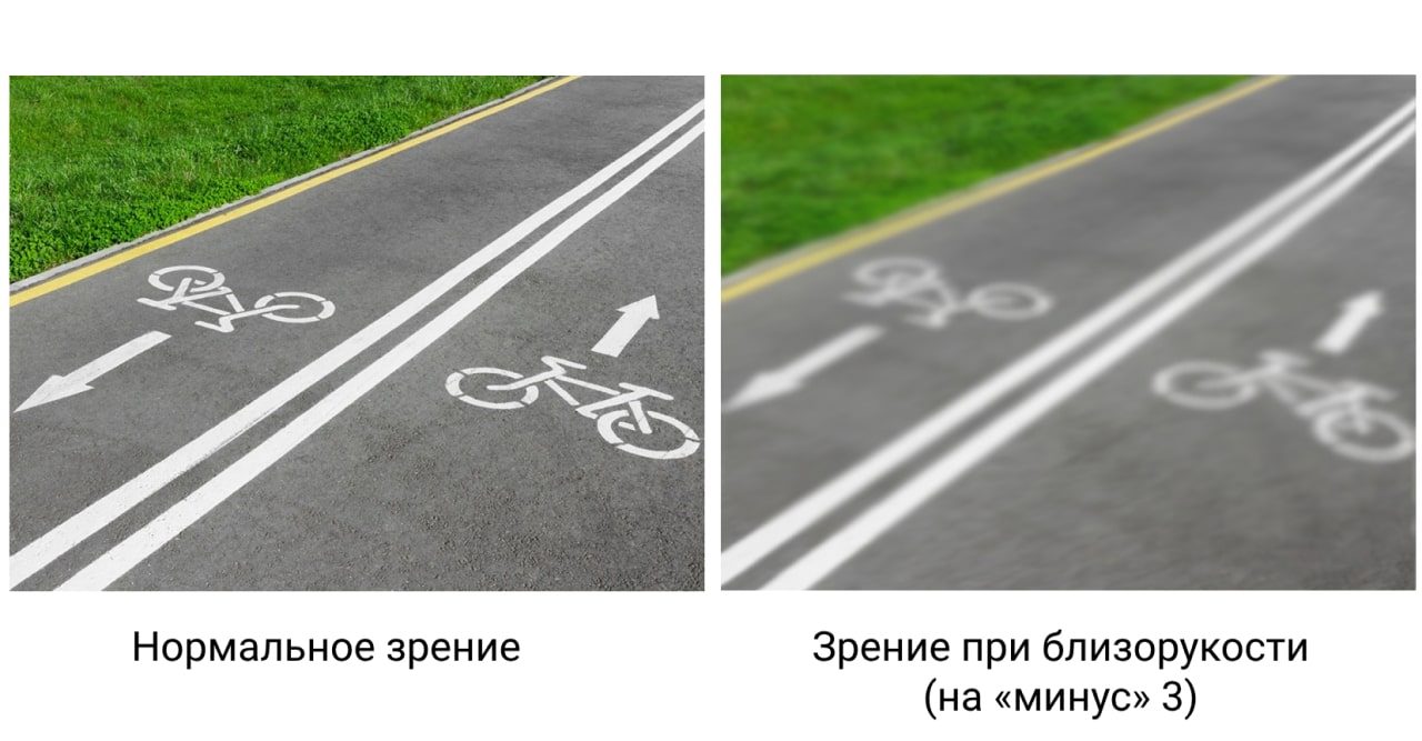Зрение при «минус» 3 диоптрии