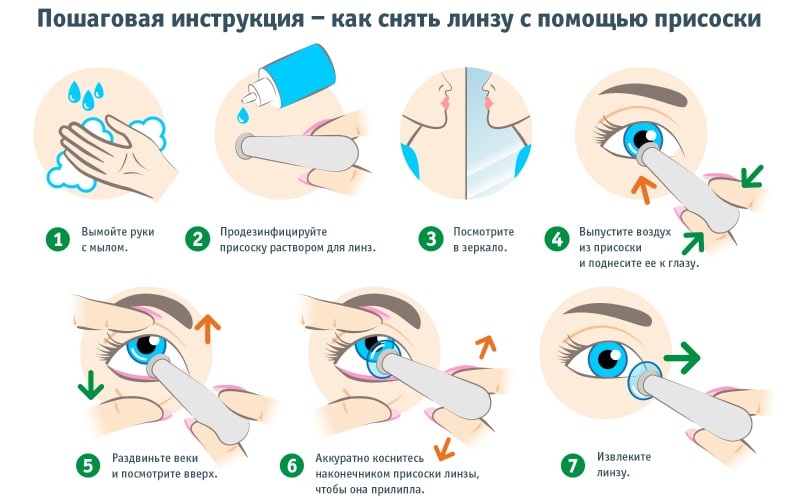 Как снять линзу с помощью присоски