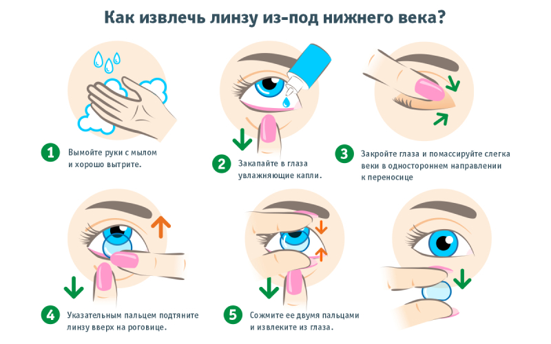 Как извлечь линзу из-под нижнего века
