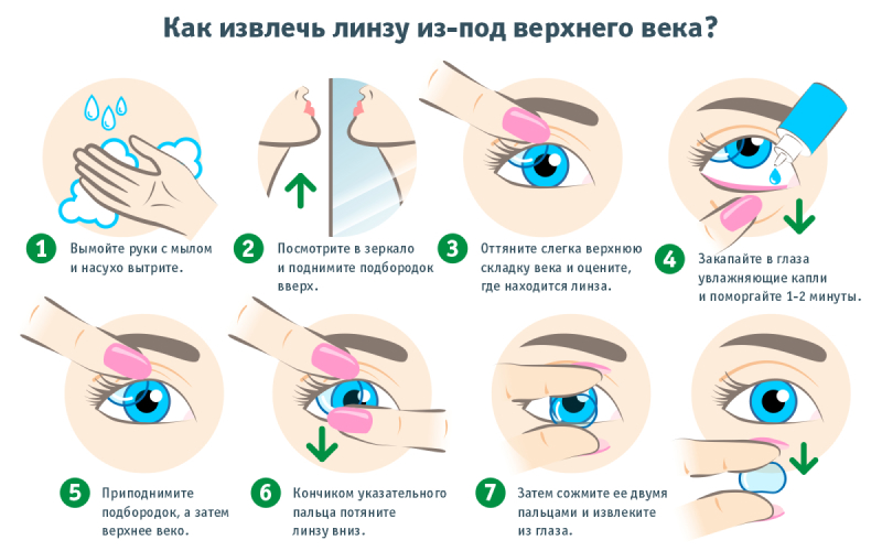Как извлечь линзу из-под верхнего века
