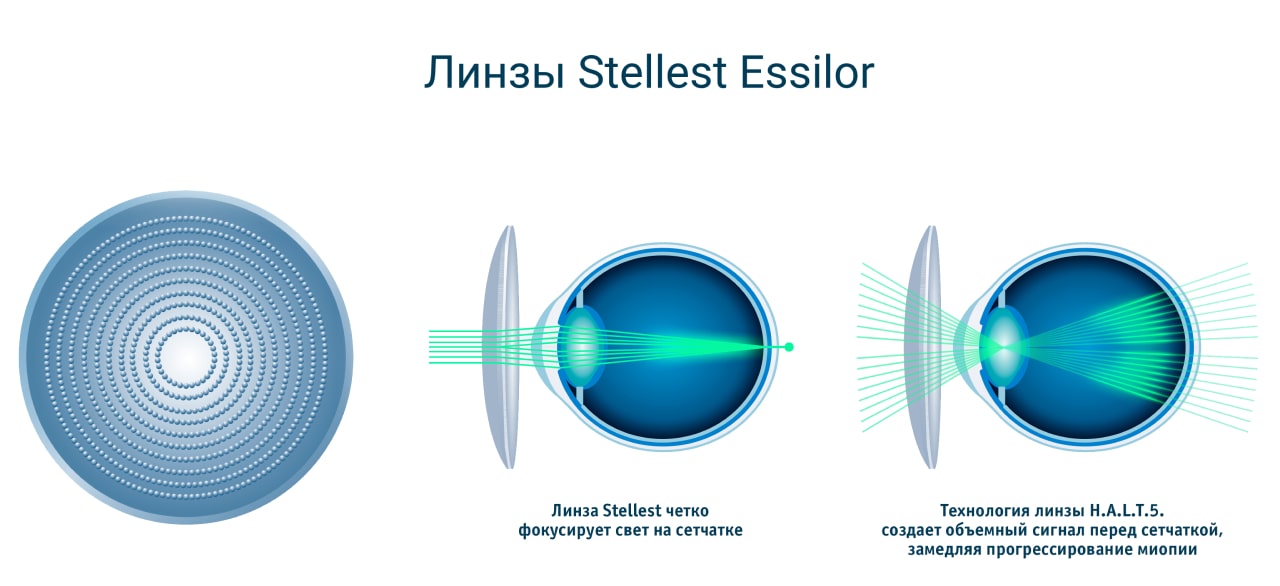 Очковые линзы Stellest Essilor