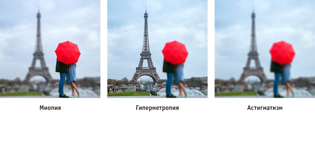 Симптомы астигматизма