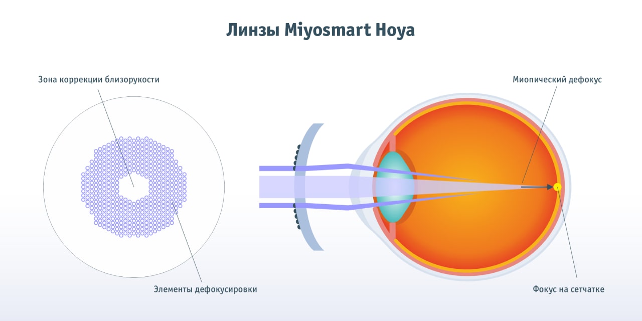 Очковые линзы MiYOSMART Hoya