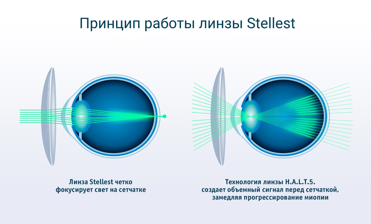 принцип работы линзы Essilor Stellest