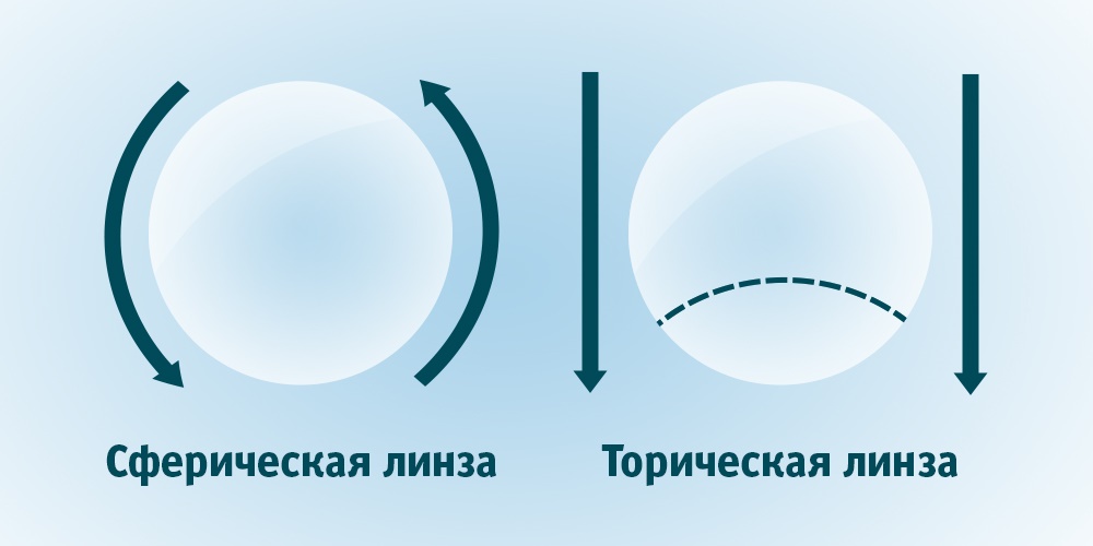 торические линзы что это