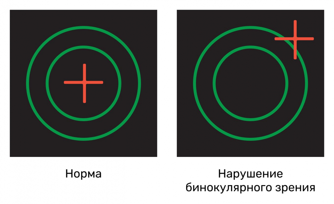 Тест Шобера - проверка бинокулярного зрения