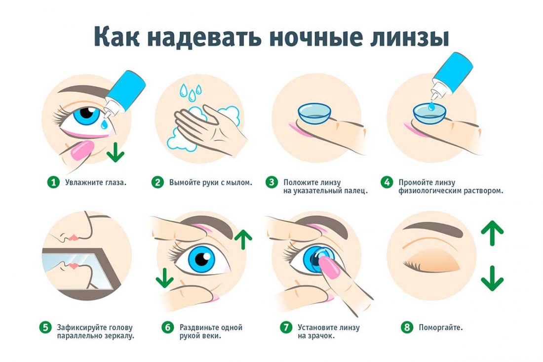 Как надеть ночные линзы