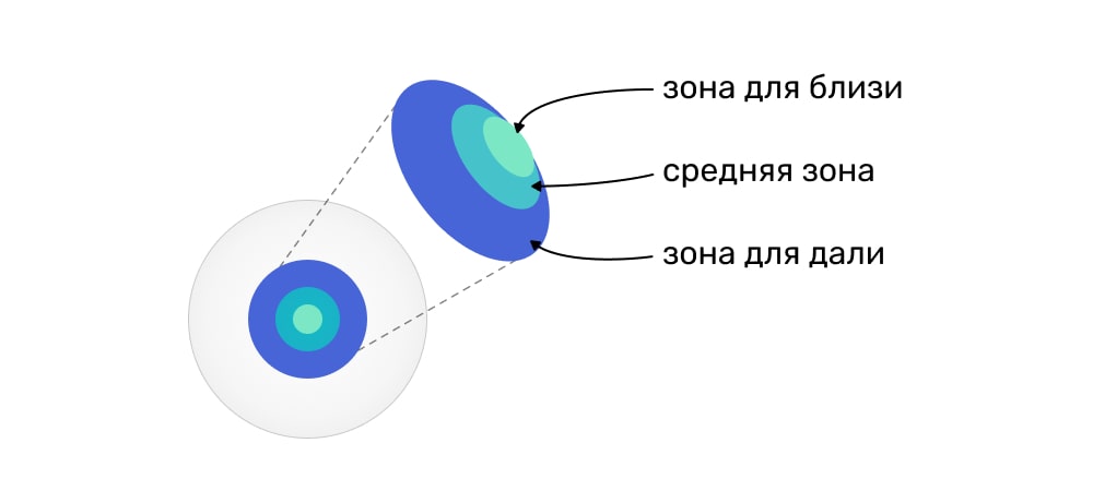 Аддидация в мультифокальной линзе