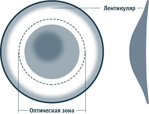 Лентикулярные