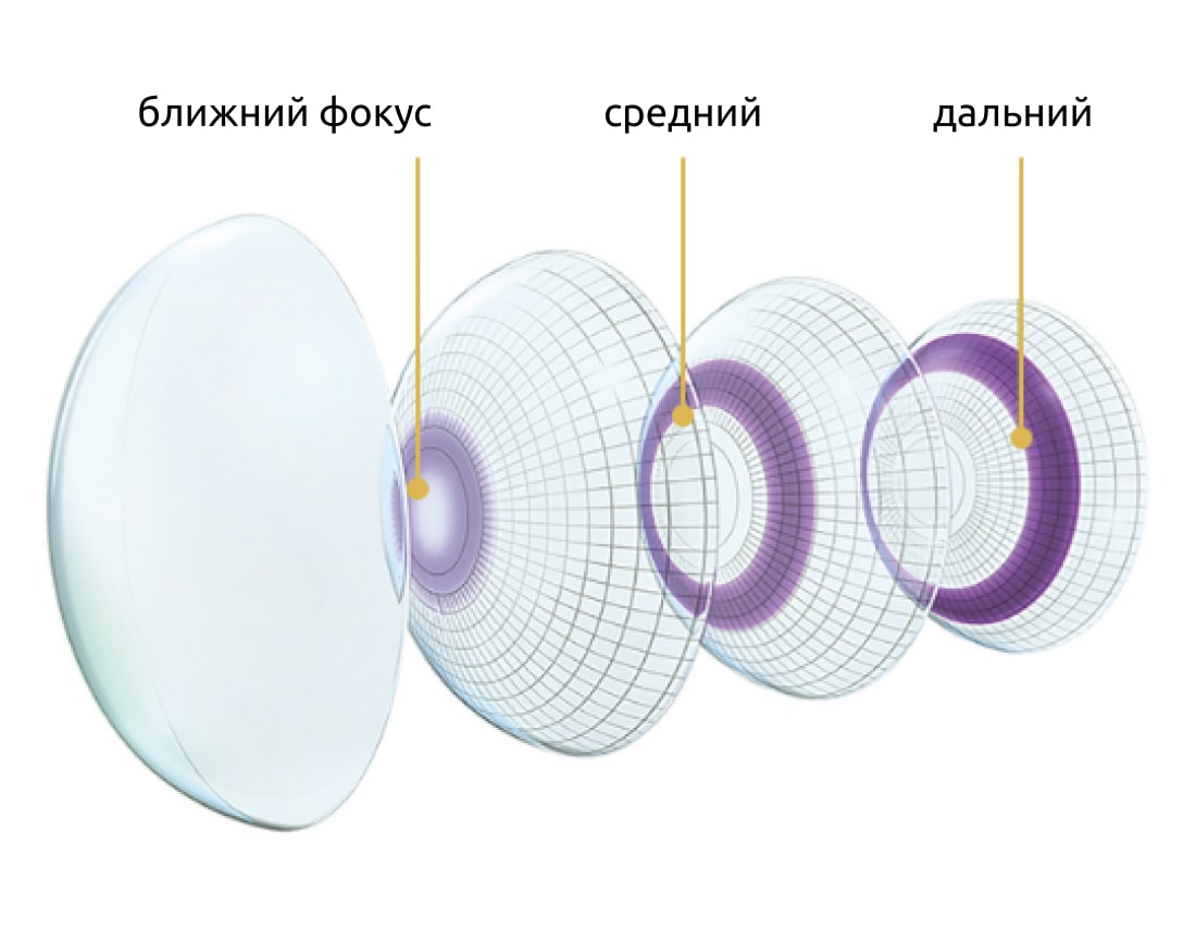мультифокальные линзы